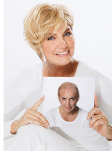 woman holding pic of herself without much hair